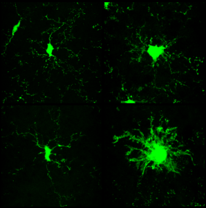 Microglia goes nuts after AraC in prion (from Gomez-Nicola et al., J Neurosci 2013)     